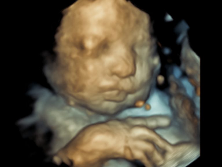3D Baby Scans Ultrasound Ireland in Dublin