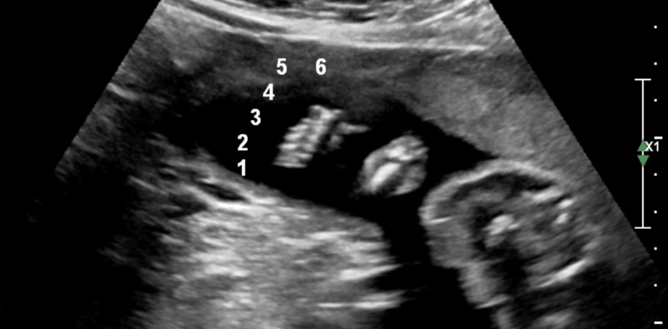 20 week ultrasound 4d