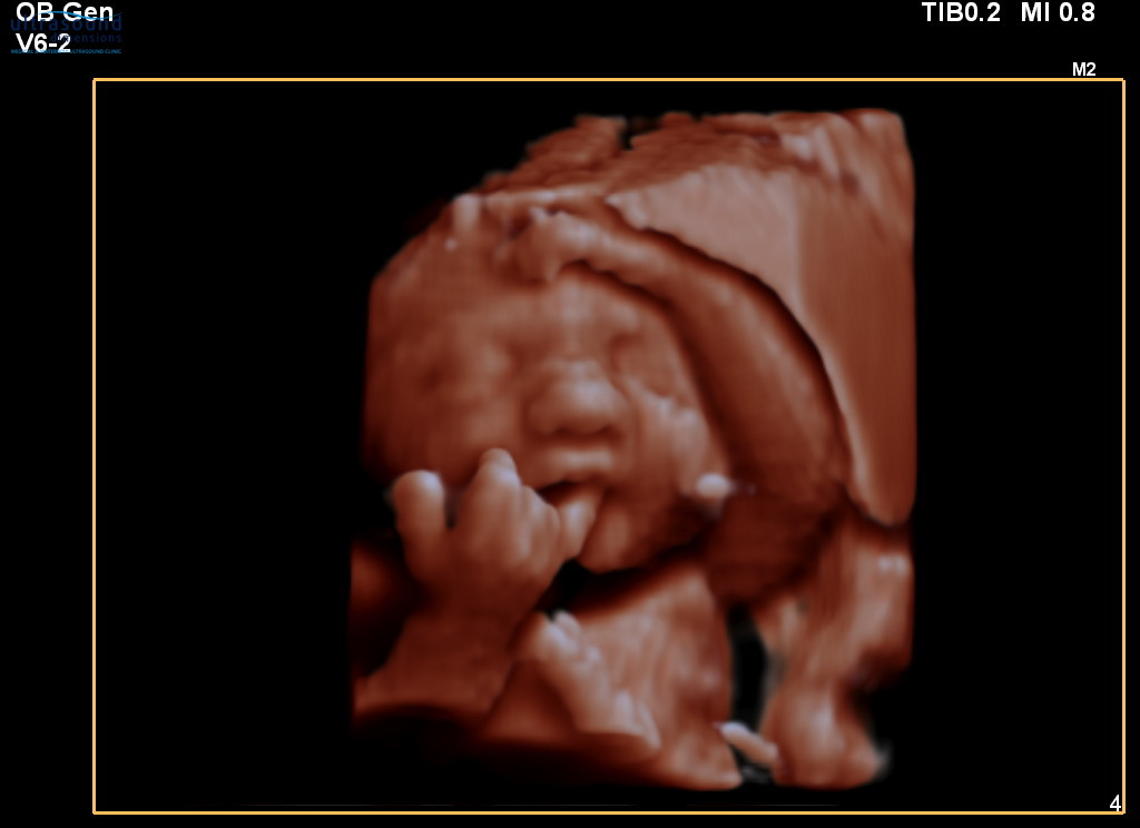 29 weeks ultrasound